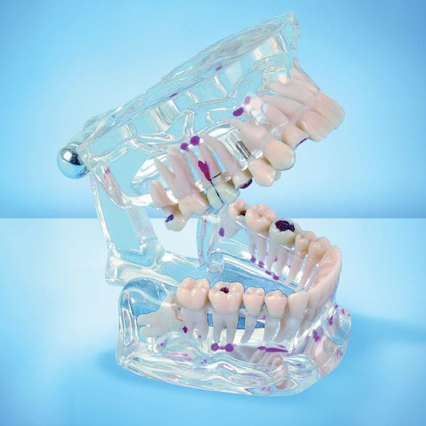 Transparant study teeth model